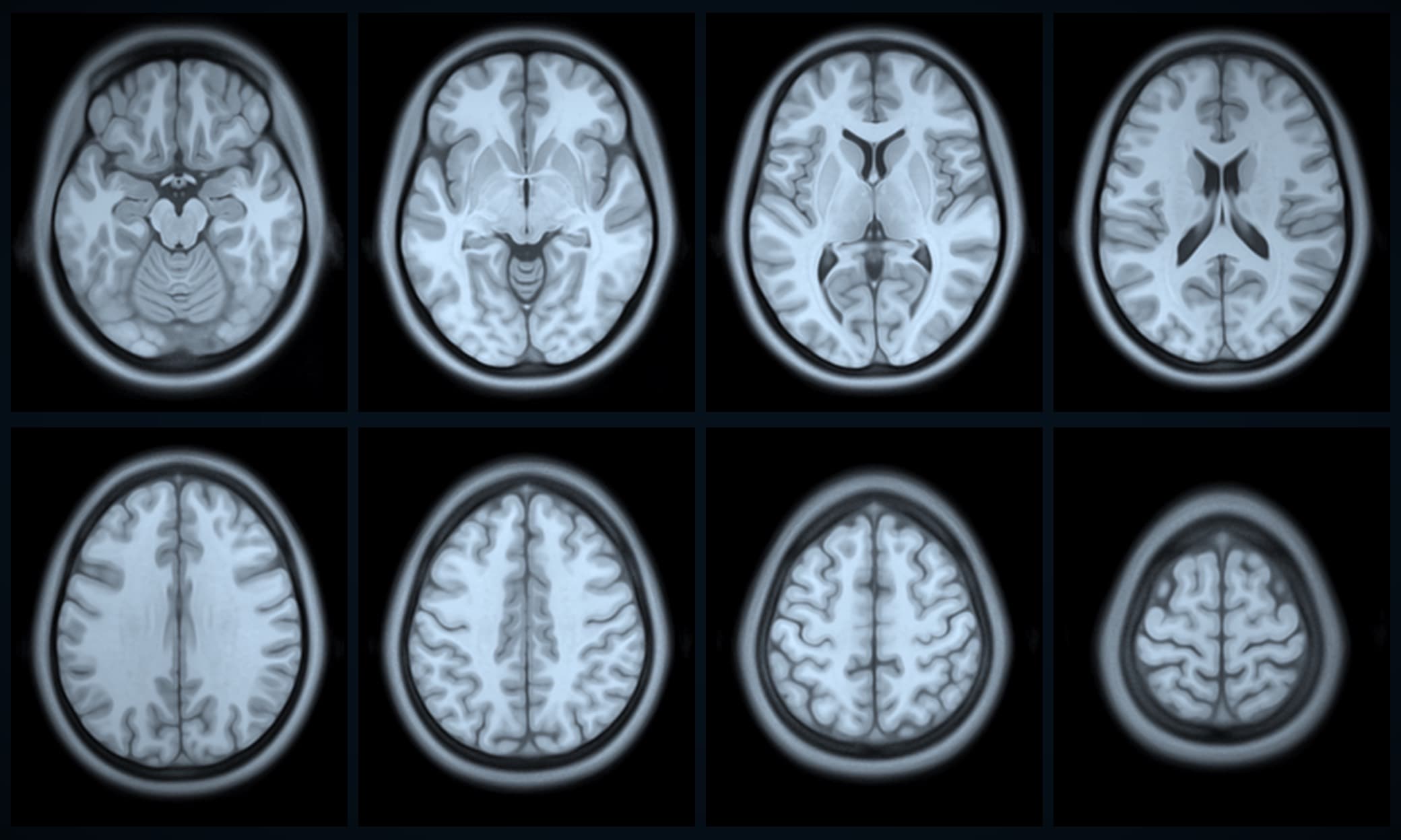 Eight axial slices through the MNI152 brain template, ascending from the cerebellum to the vertex
