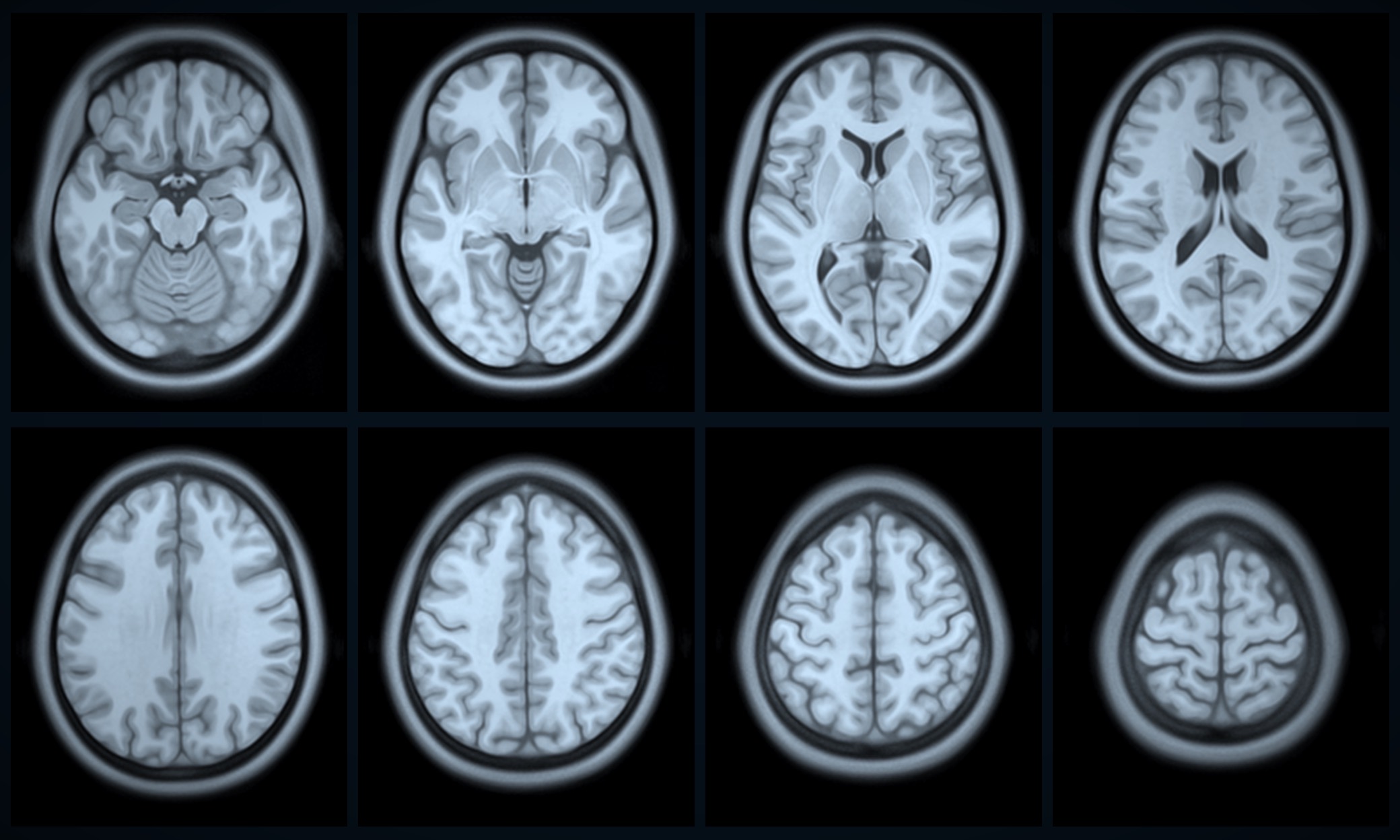 Eight axial slices through the MNI152 brain template, ascending from the cerebellum to the vertex